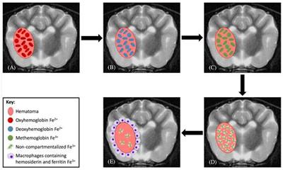 1.5 Tesla Magnetic Resonance Imaging Features of Canine Intracranial Intra-axial Hematomas